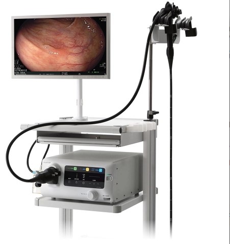 Máy nội soi tiêu hóa EP-6000